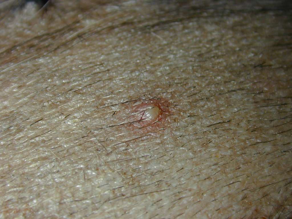 Cytology blog fig 1